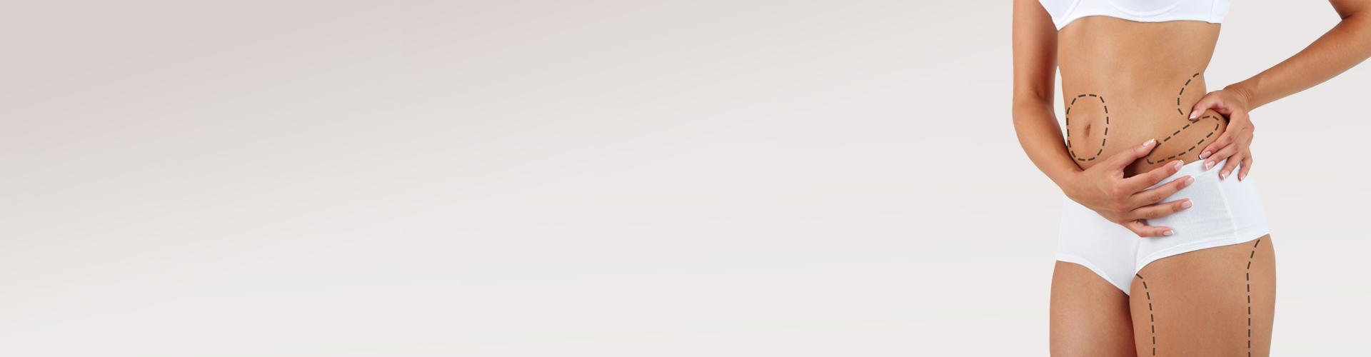 O 20 % podchlazená cena na nejúčinnější likvidaci tuku mrazem Cooltech